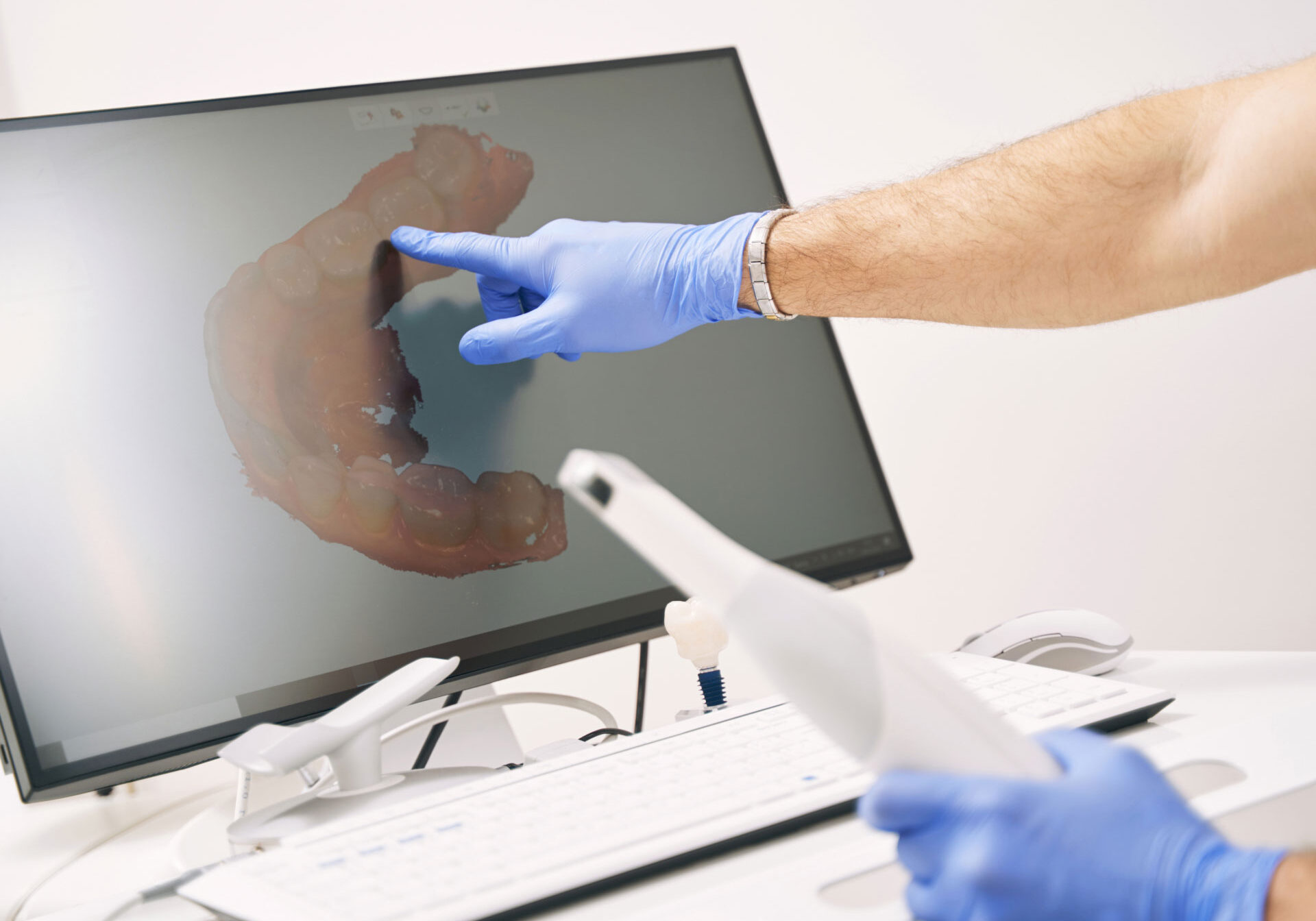 dentist pointing to dental scan on screen of itero machine